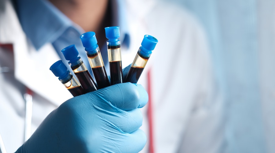 Tam Kan Sayımı (Hemogram) Testi Nedir? Neden Yapılır?