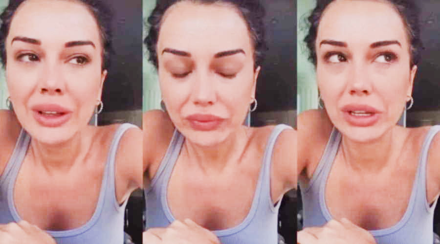 Dilan Polat hastalığını açıkladı; duyan anlamadı! “Lupus hastalığı nedir?”