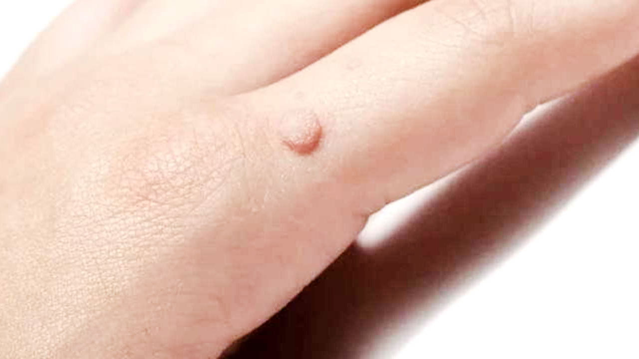 Uşaklılar, siğille gezmek zorunda değilsiniz! Sadece 1 günde geçiyor