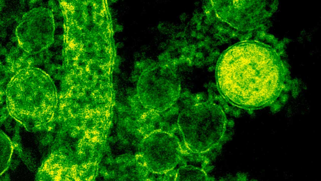 H5N2 virüsü korkusu artıyor, nasıl korunabiliriz?