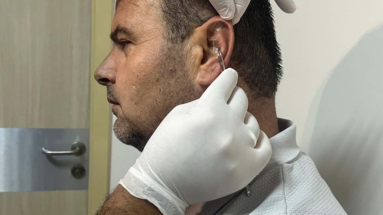 Ağrılara, strese ve uykusuzluğa yeni destek Uşak’ta akupunktur hizmeti başladı