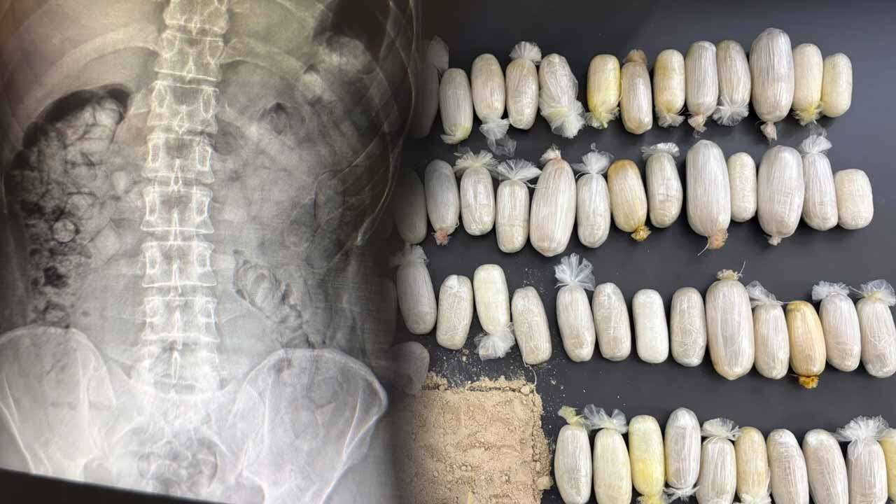 Uşak'ta Yakalanan İranlıların Midesinden Uyuşturucu Çıktı