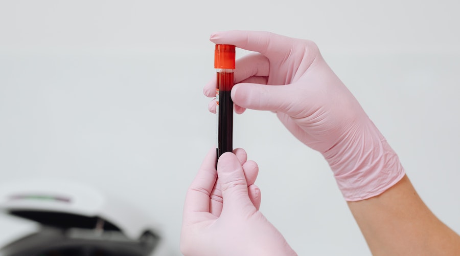 kan-testi-4.jpg